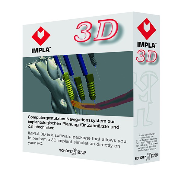 IMPLA 3D-software voor tandarts / implantoloog