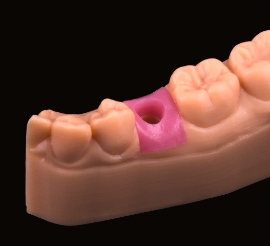 3D-printmateriaal gingiva