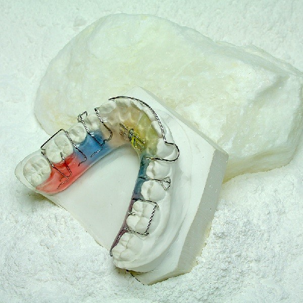 Natura modelhardgips (orthodontie)