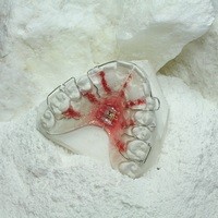 Ortho Plaster natuur modelhardgips (orthodontie)